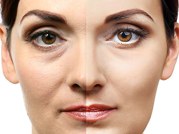 beautylight plus suntime wuerselen03